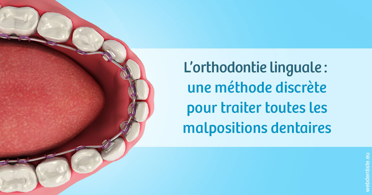 https://dr-philippe-borel.chirurgiens-dentistes.fr/L'orthodontie linguale 1
