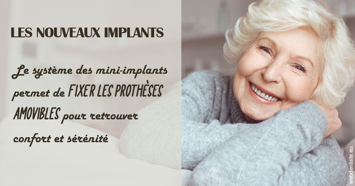 https://dr-philippe-borel.chirurgiens-dentistes.fr/Les nouveaux implants 1