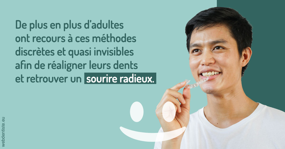 https://dr-philippe-borel.chirurgiens-dentistes.fr/Gouttières sourire radieux 2