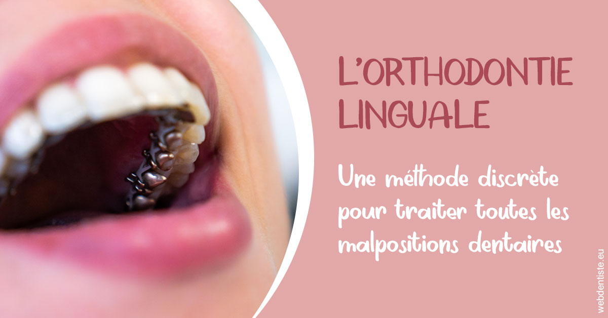 https://dr-philippe-borel.chirurgiens-dentistes.fr/L'orthodontie linguale 2