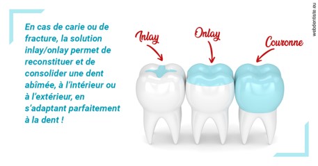 https://dr-philippe-borel.chirurgiens-dentistes.fr/L'INLAY ou l'ONLAY
