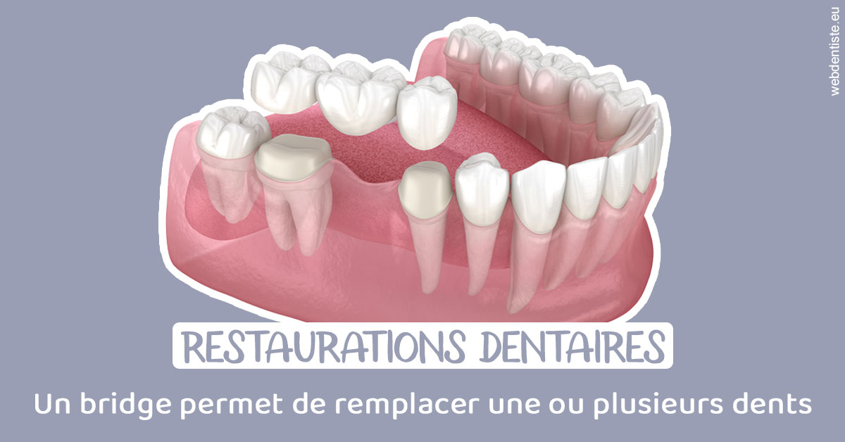 https://dr-philippe-borel.chirurgiens-dentistes.fr/Bridge remplacer dents 1