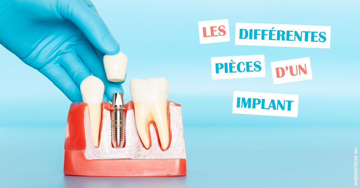 https://dr-philippe-borel.chirurgiens-dentistes.fr/Les différentes pièces d’un implant 2