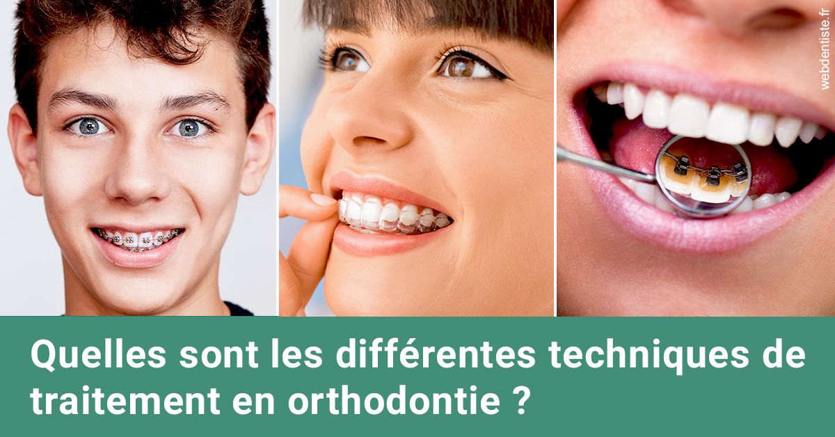 https://dr-philippe-borel.chirurgiens-dentistes.fr/Les différentes techniques de traitement 2