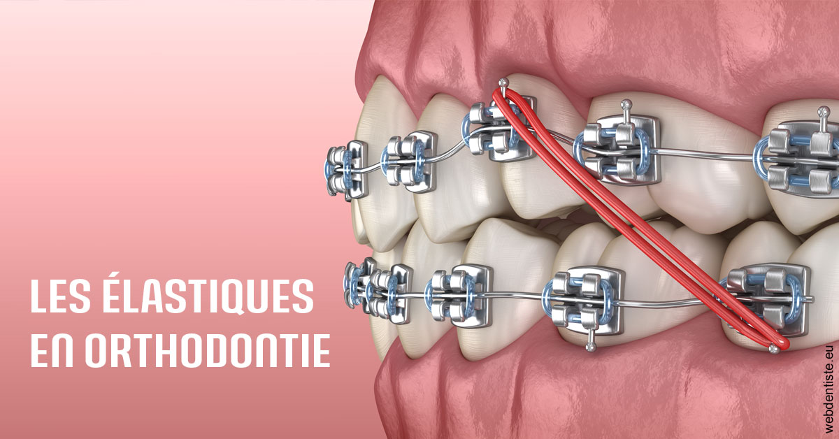 https://dr-philippe-borel.chirurgiens-dentistes.fr/Elastiques orthodontie 2